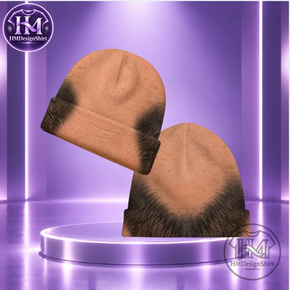 Fake Hair Balding Head Fluffy Beanie Winter Cap 2026 4 Fake Hair Balding Head Fluffy Beanie Winter Cap 2026